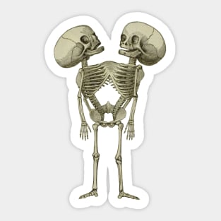 Siamese Twins Skeleton Sticker